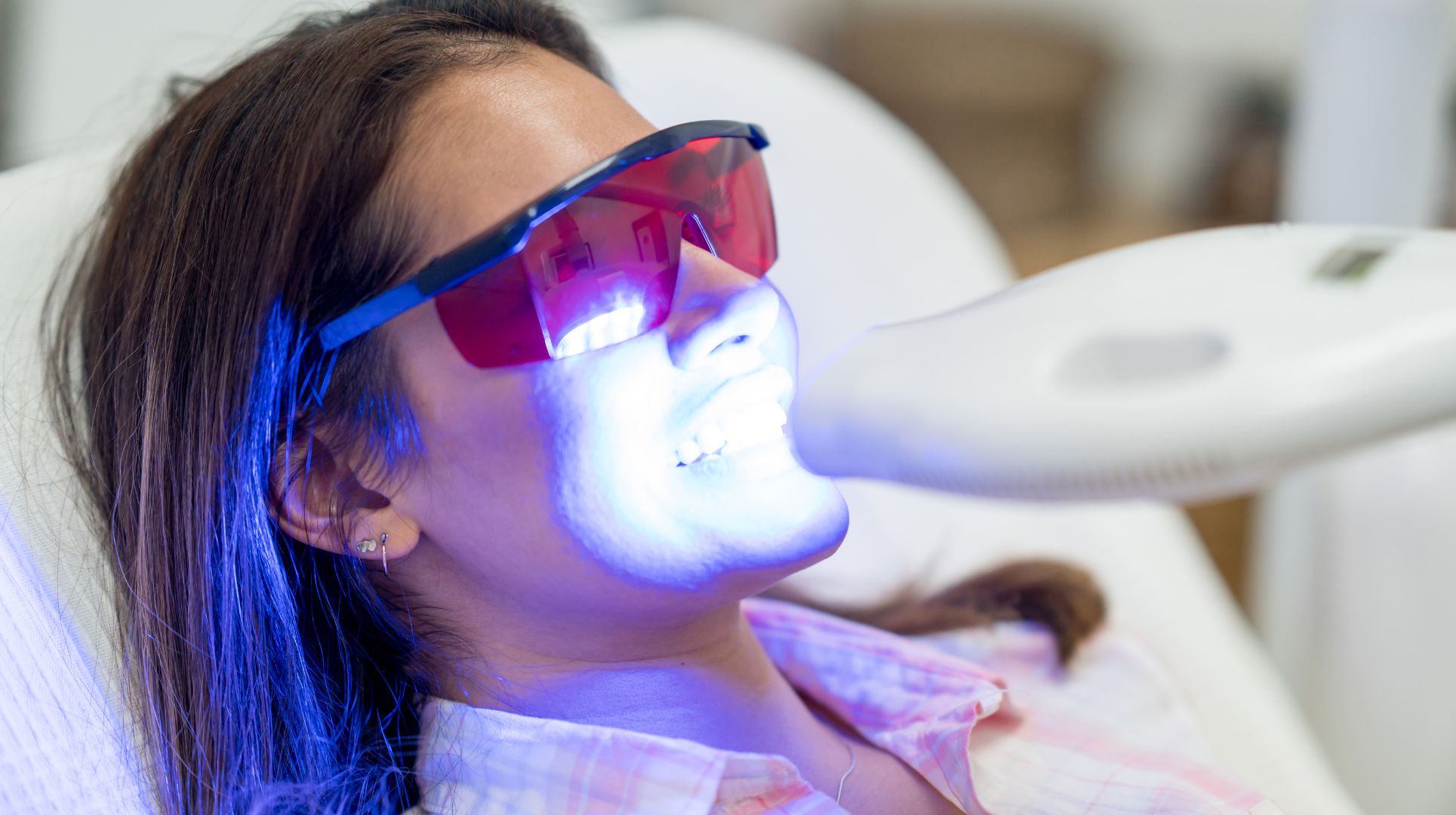 blanqueamiento dental en cordoba (2)