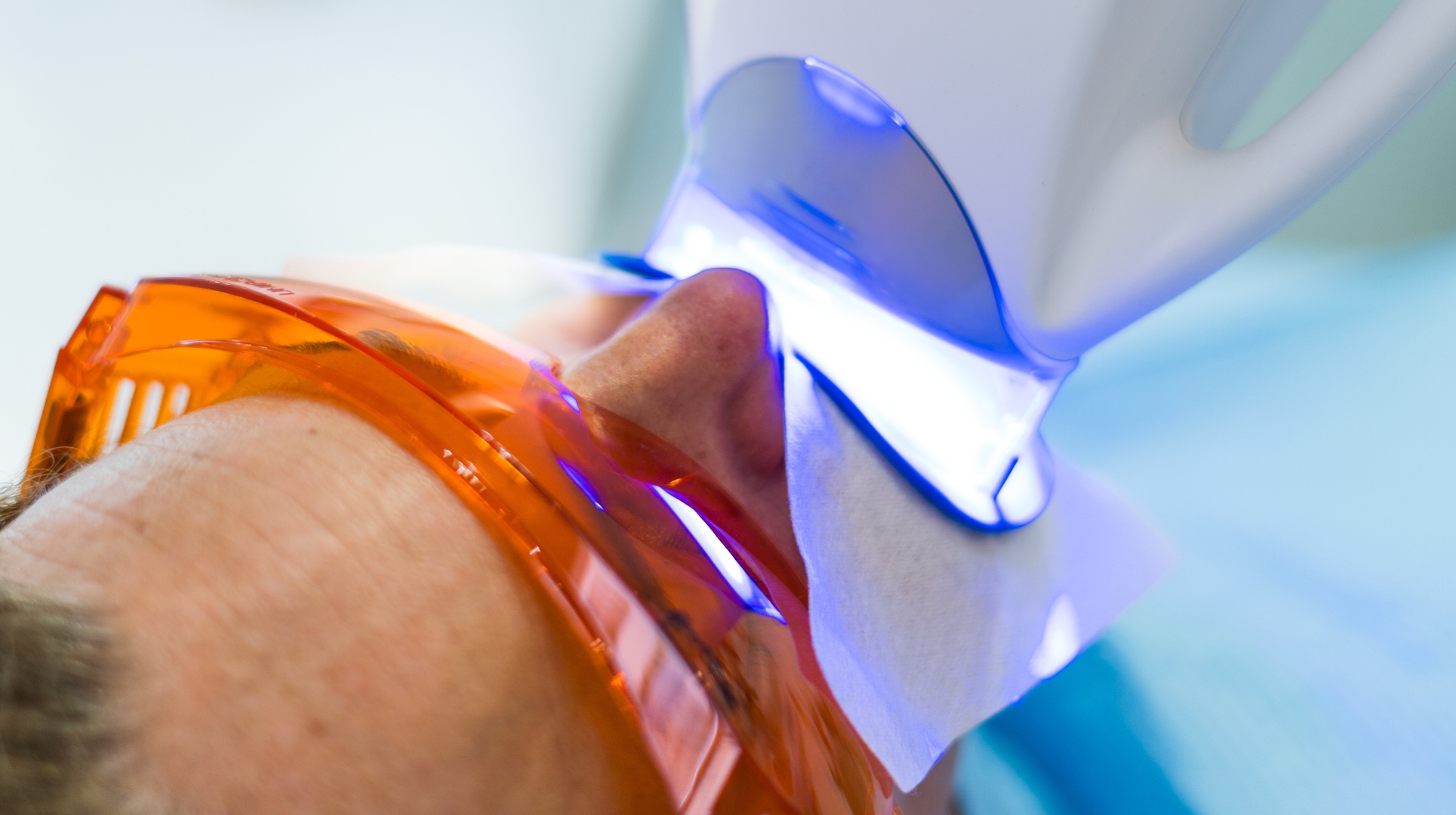 blanqueamiento dental en cordoba (1)