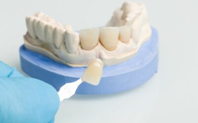 ¿Qué es mejor carillas de composite o de porcelana?